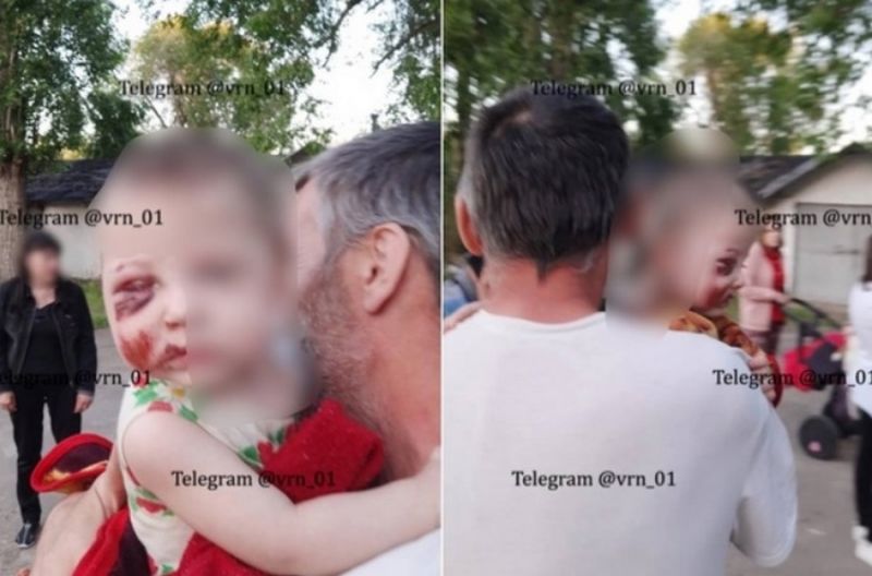 О состоянии жестоко избитой в Воронеже годовалой малышки рассказали врачи